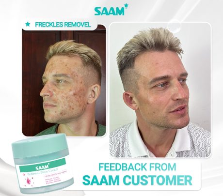 SAAM Renewal Face Cream – Brightening Care for Melasma & Freckles - Desertcart.store
