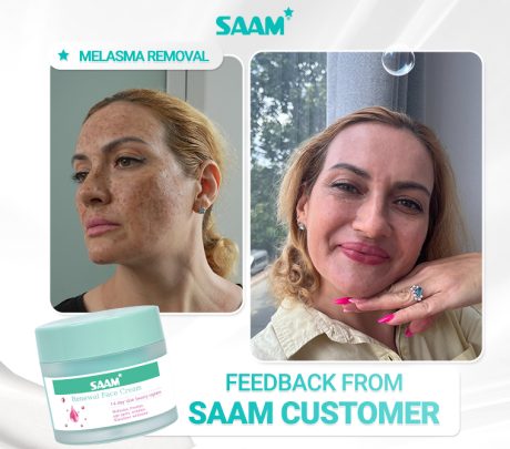 SAAM Renewal Face Cream – Brightening Care for Melasma & Freckles - Desertcart.store