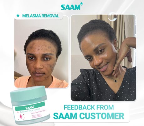 SAAM Renewal Face Cream – Brightening Care for Melasma & Freckles - Desertcart.store