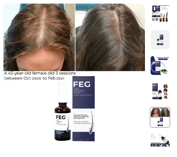 Hair Growth Spray - Desertcart.store