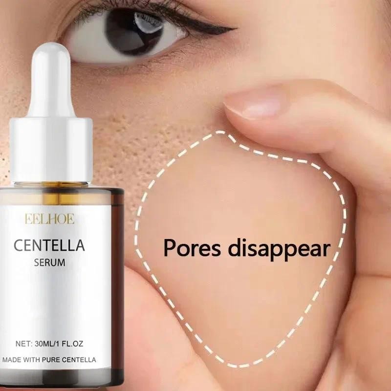 Centella Asiatica Face Serum Nourish Dry Skin Smoothing Rejuvenation Skin Brightening Whitening Cream Facial Moisturizer Korean - Desertcart.store