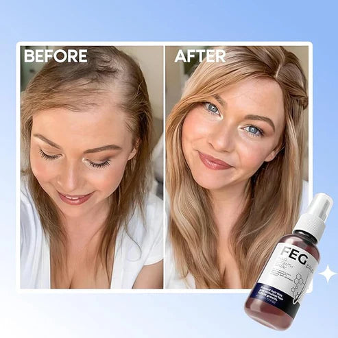 “FEG Hair Growth Serum” Thermos pro