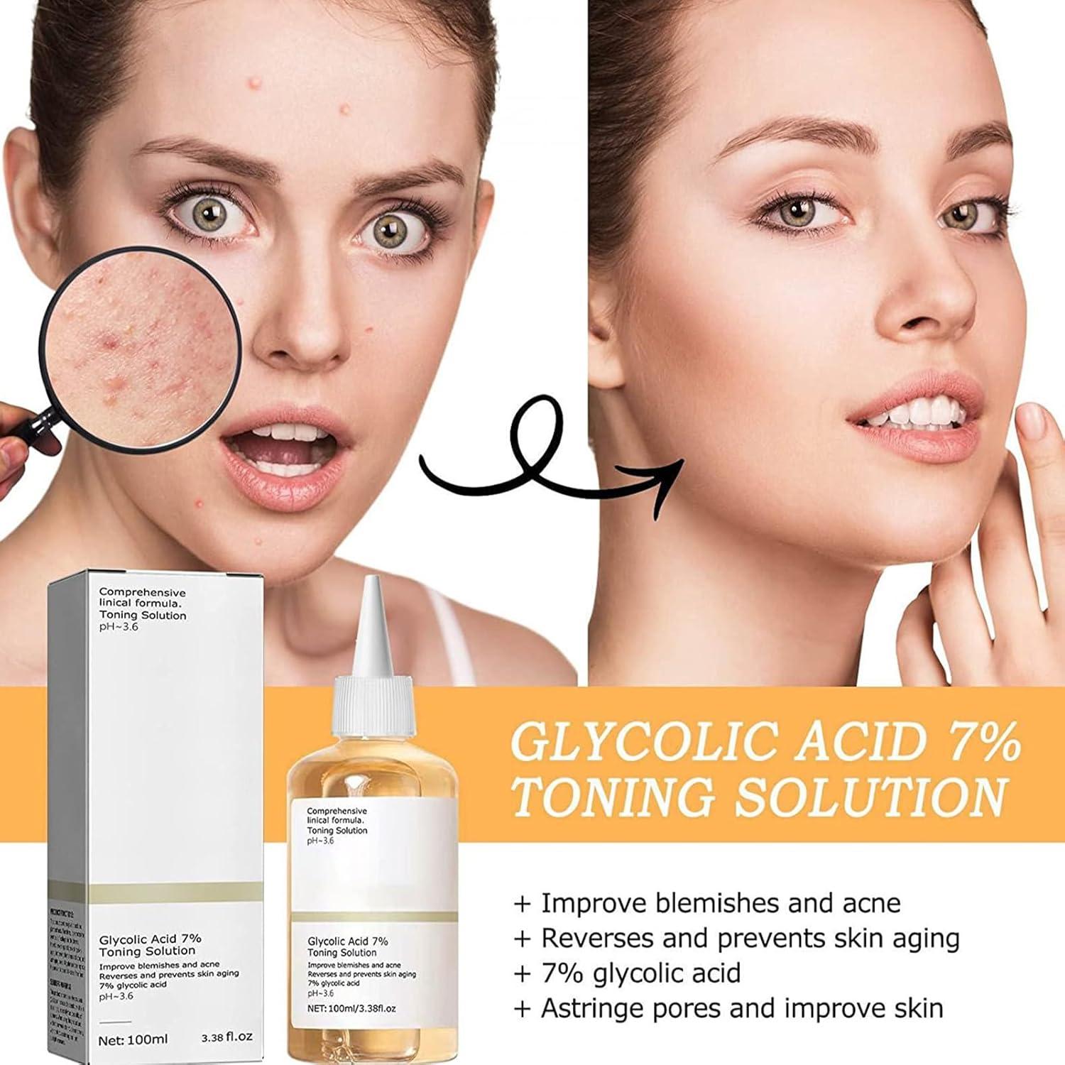 100ml Glycolic Acid 7% Toning Solution To Remove Acne and Moisturize Skin Rejuvenating Lotion - Desertcart.store