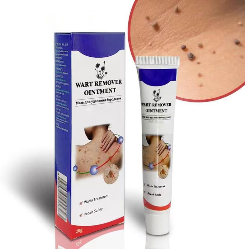 Warts Remover Ointment – Fast, Gentle &amp; Effective Treatment for Warts - Desertcart.store