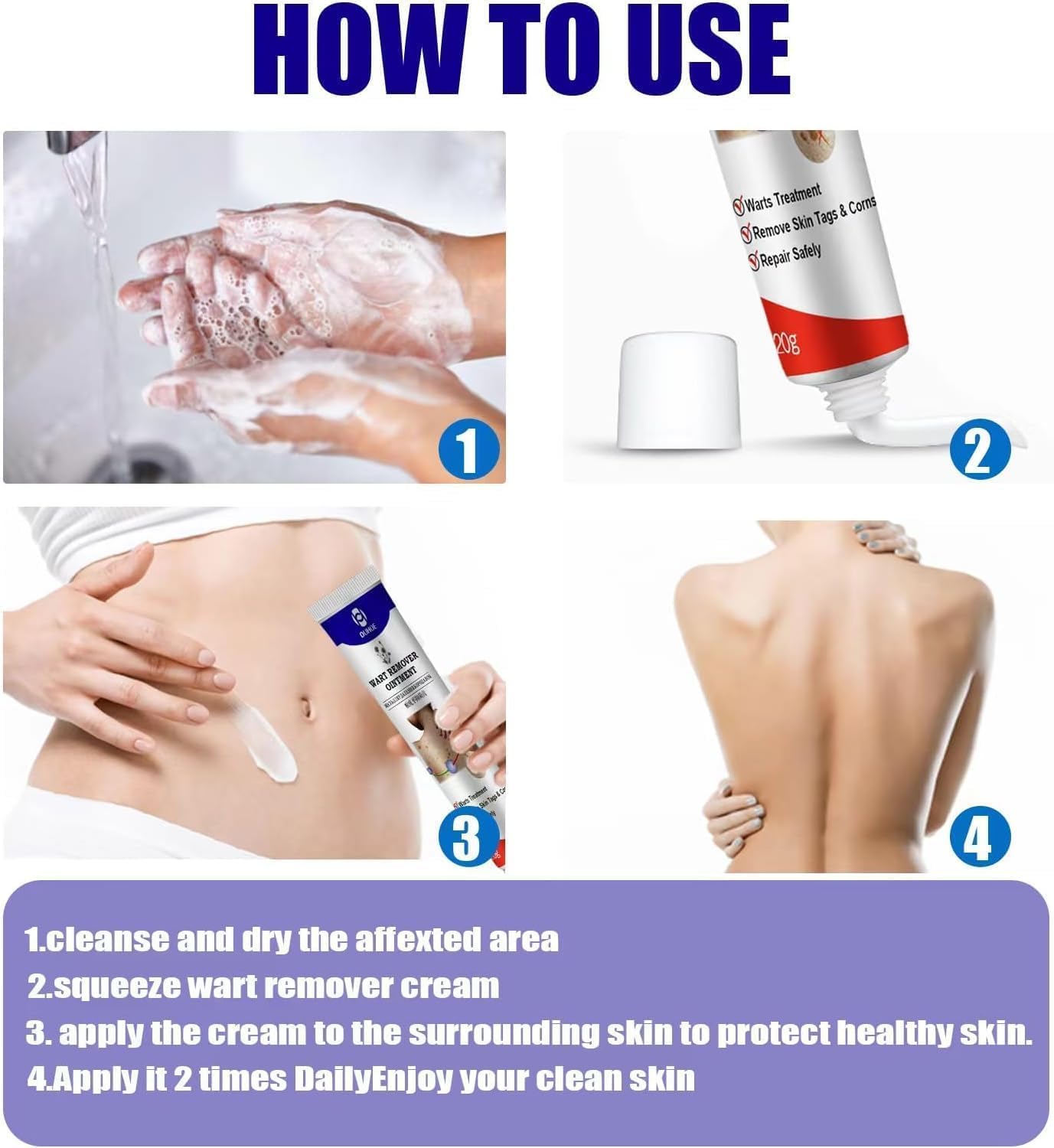 Warts Remover Ointment – Fast, Gentle &amp; Effective Treatment for Warts - Desertcart.store