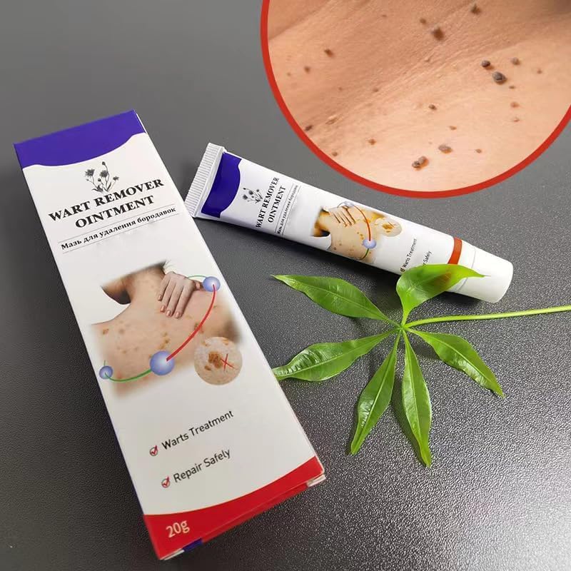 Warts Remover Ointment – Fast, Gentle &amp; Effective Treatment for Warts - Desertcart.store